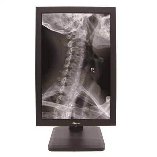 21.3 Inch 5MP Monitor Skala Kelabu